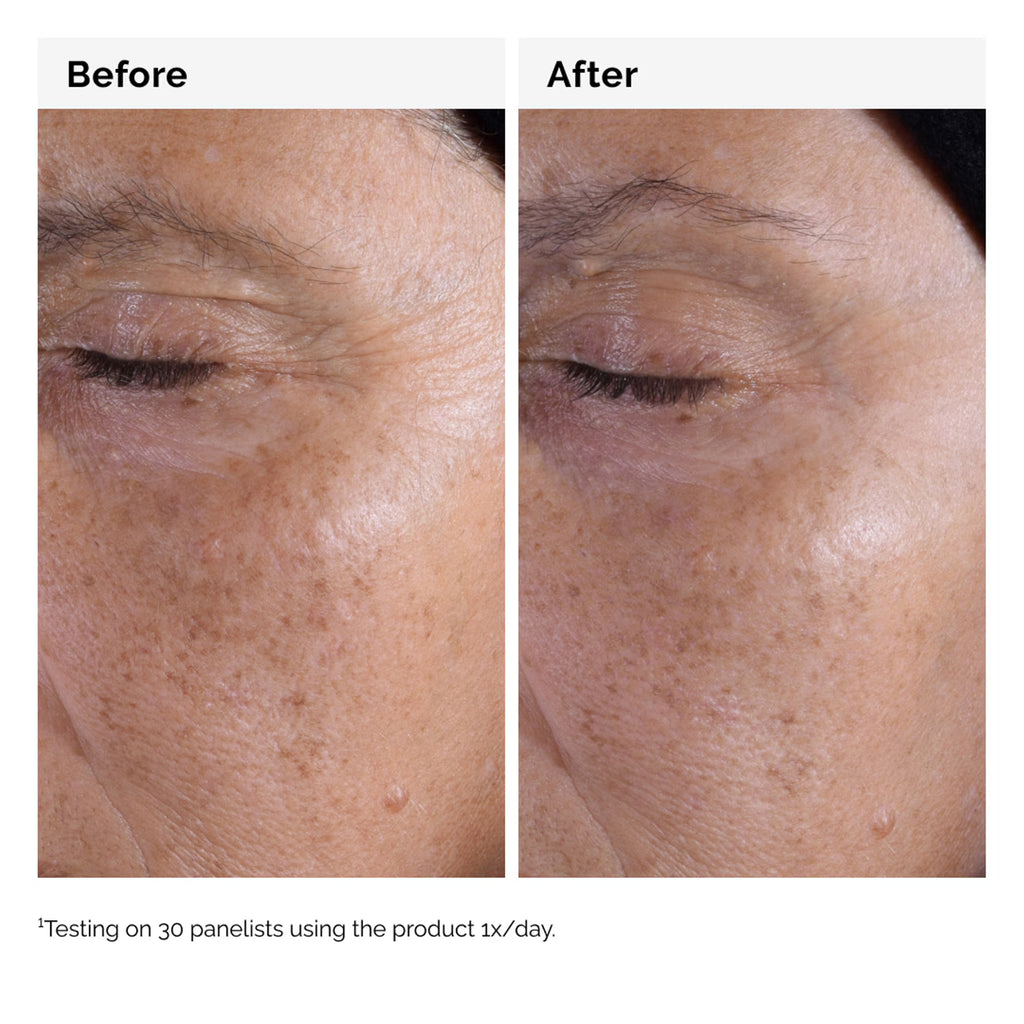 Tonique Exfoliant à l'Acide Glycolique 7% - Lotion Exfoliante